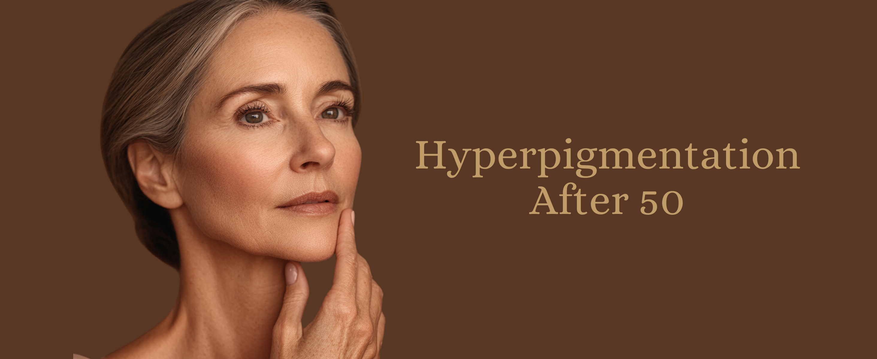 Hyperpigmentation After 50.