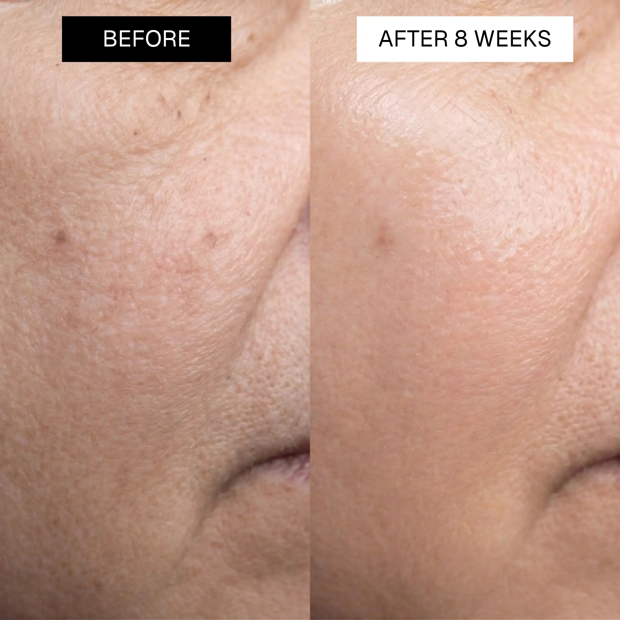 Radiance Ultimate Brightening Mask