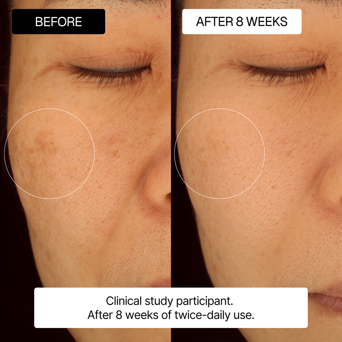 The 3-Step Melasma & Dark Spot Set