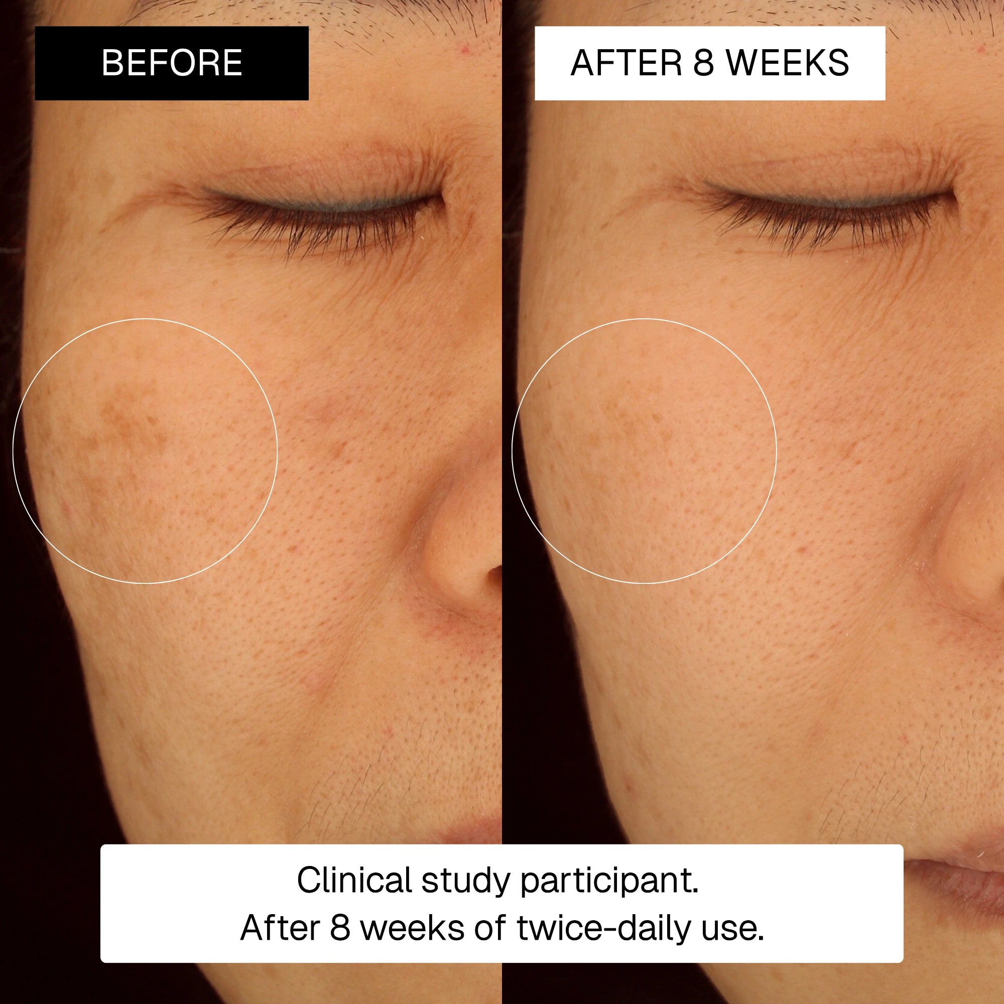 3-Step Dark Spot & Fine Lines Travel Set