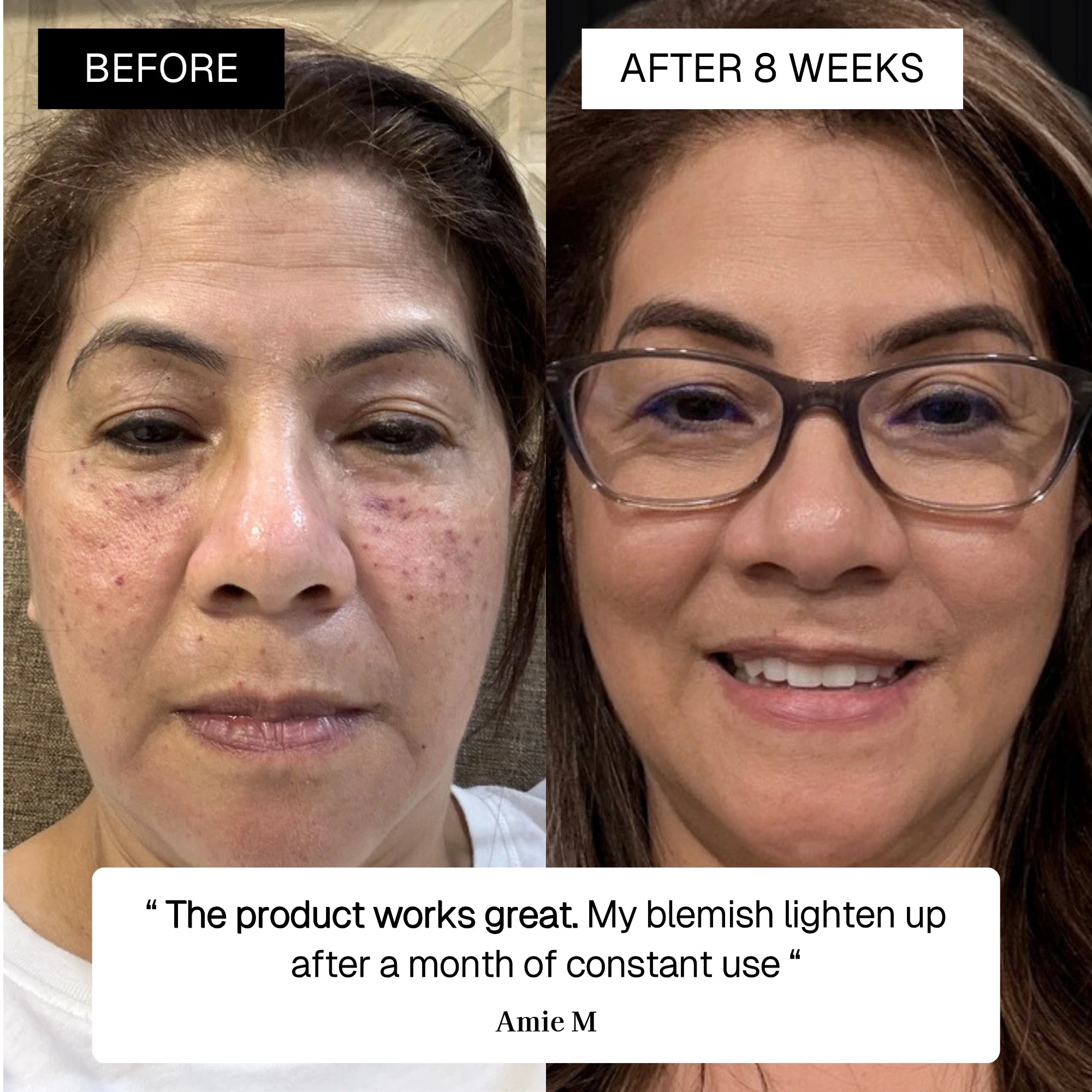 The Radiance Plan Dark Spot Kit