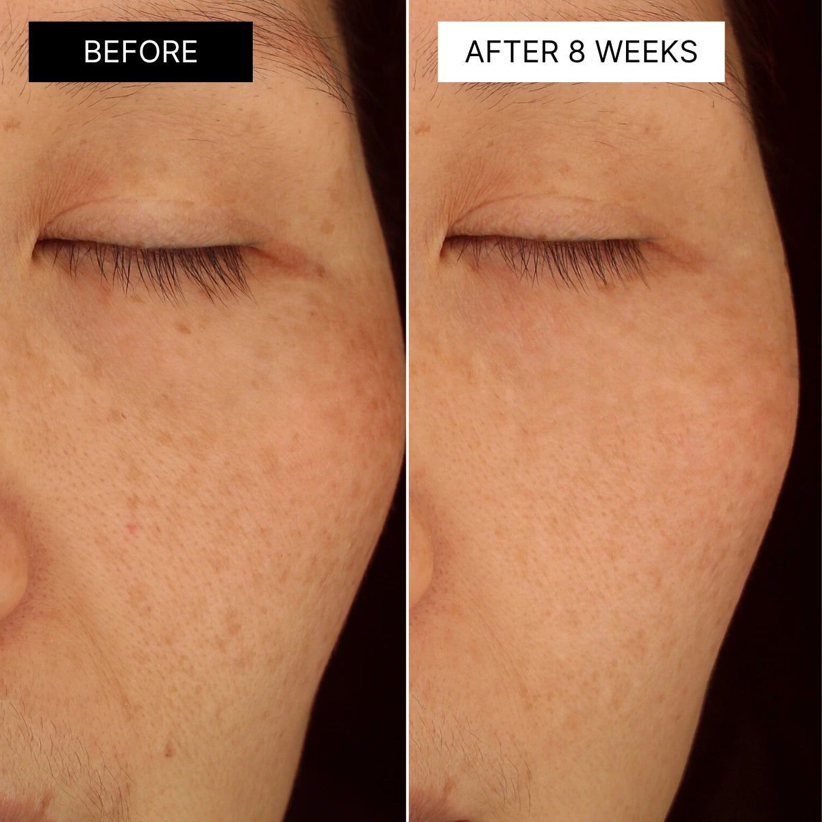 The Brightening Mask