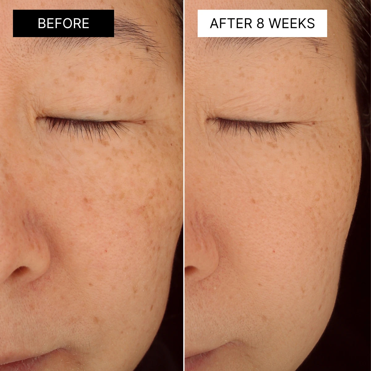 The Korean Dark Spot Kit