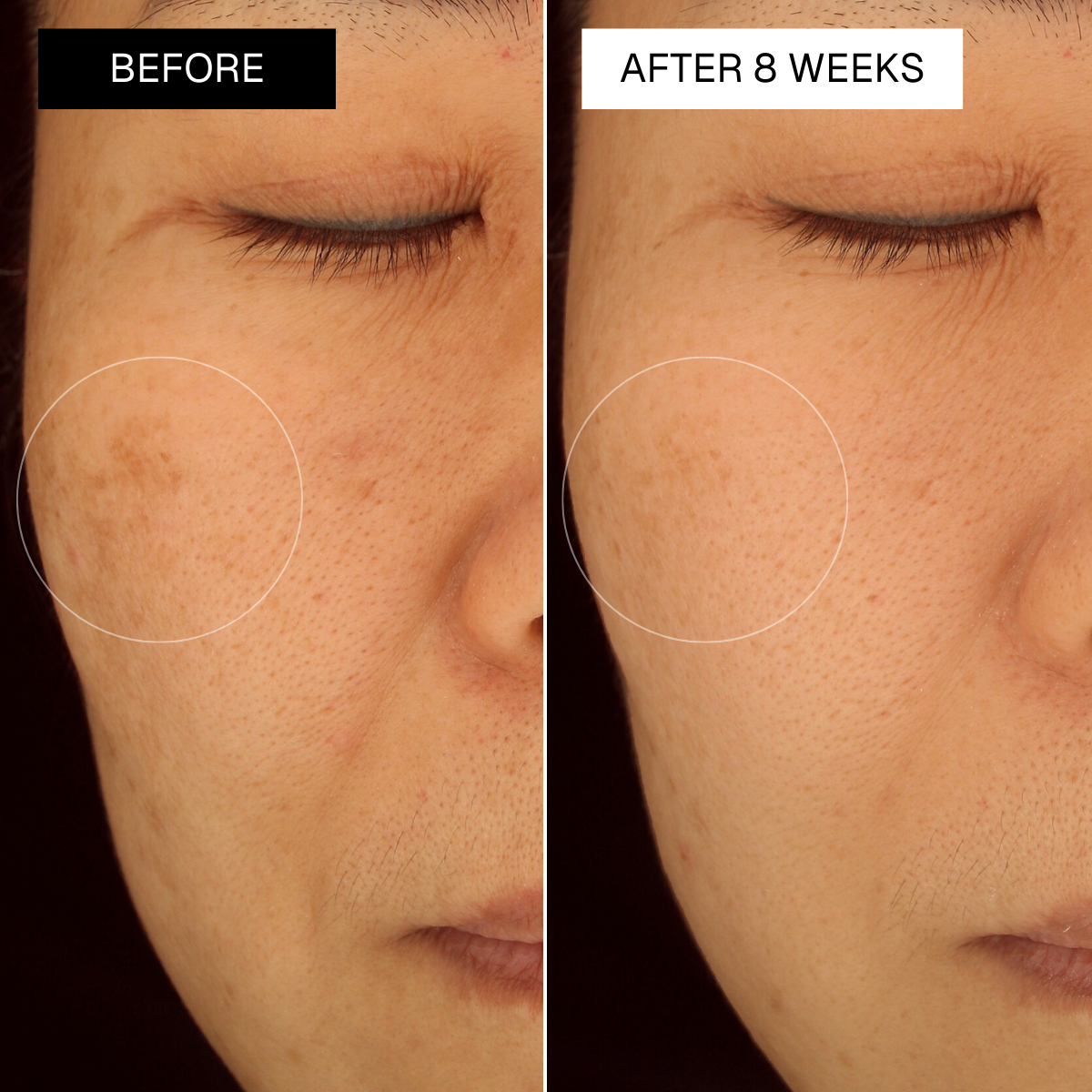 Radiance Plan Dark Spot Set for Mature Skin