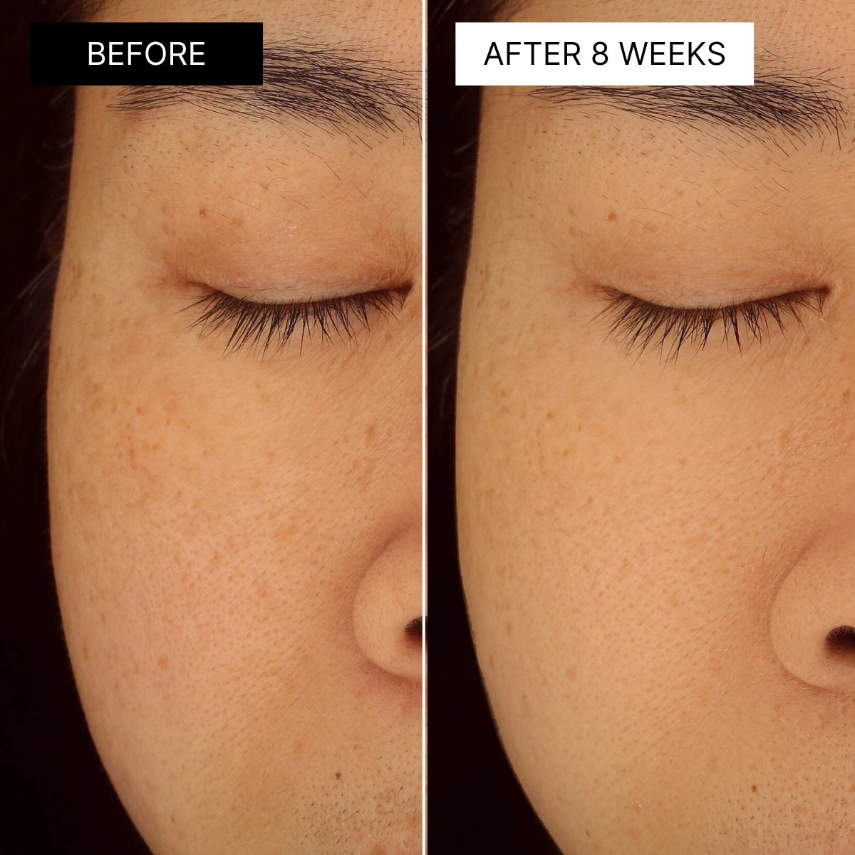 The Brightening Mask