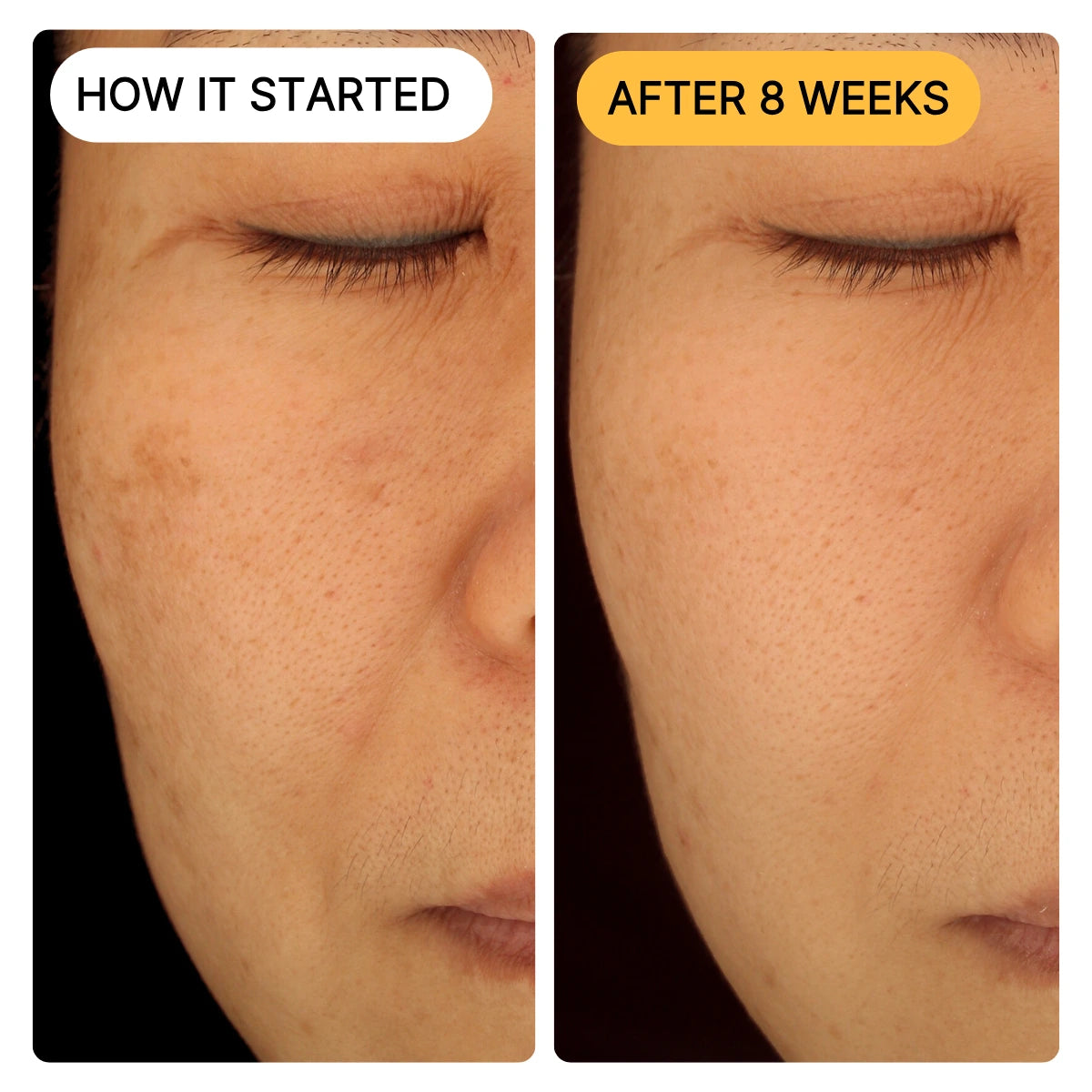 Discovery & Travel Kit for Dark Spots