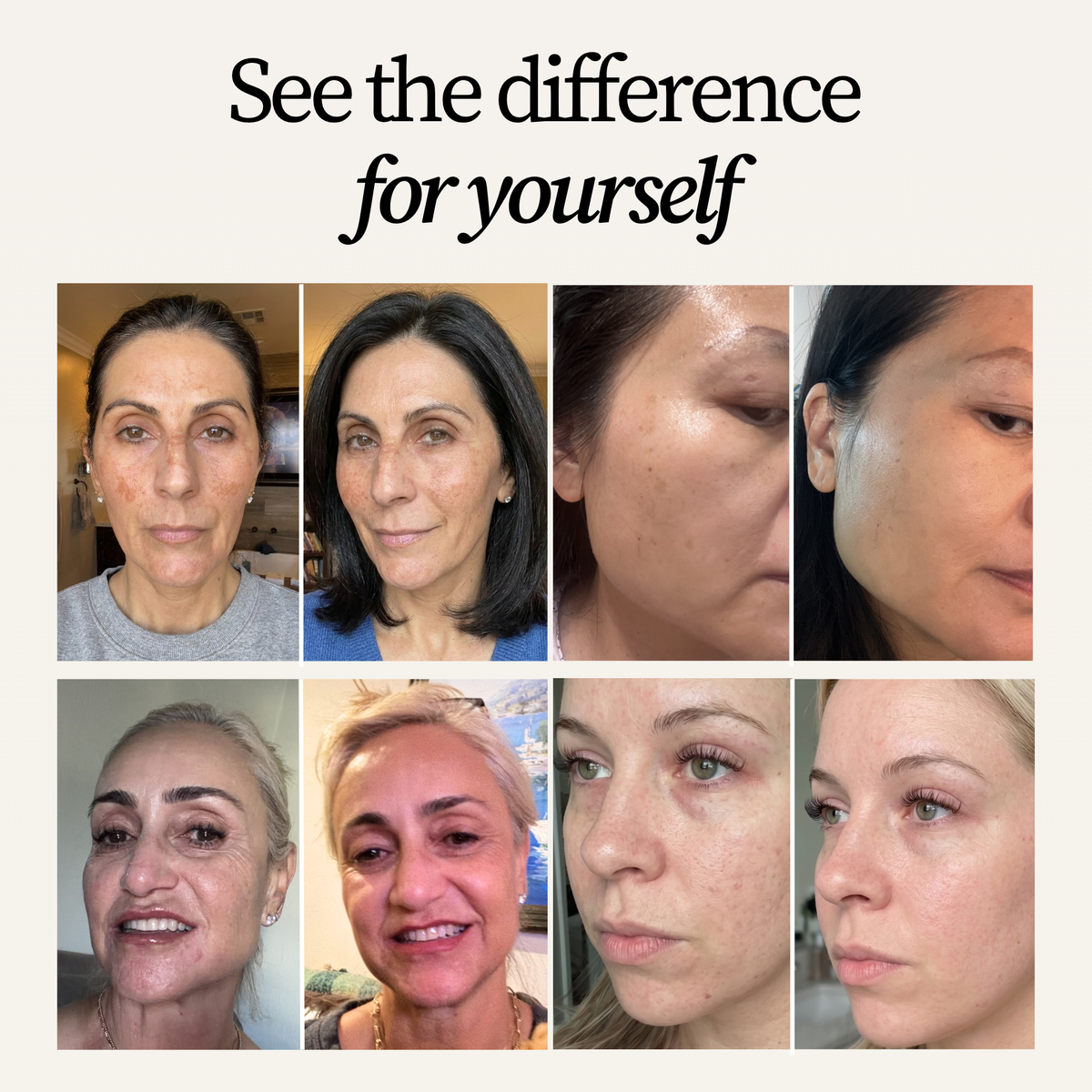 The 3-Step Melasma & Dark Spot Set