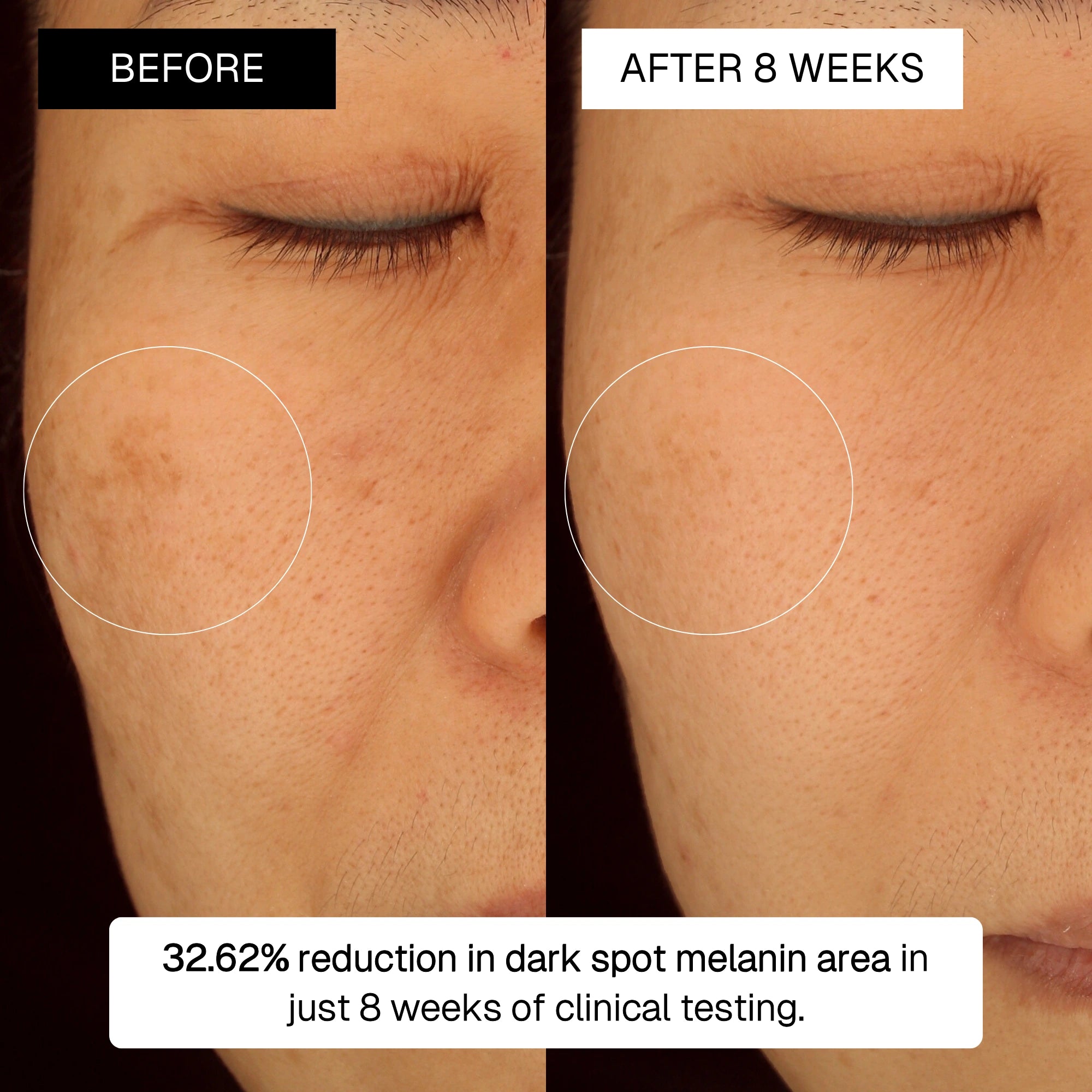 The Radiance Plan Dark Spot Kit