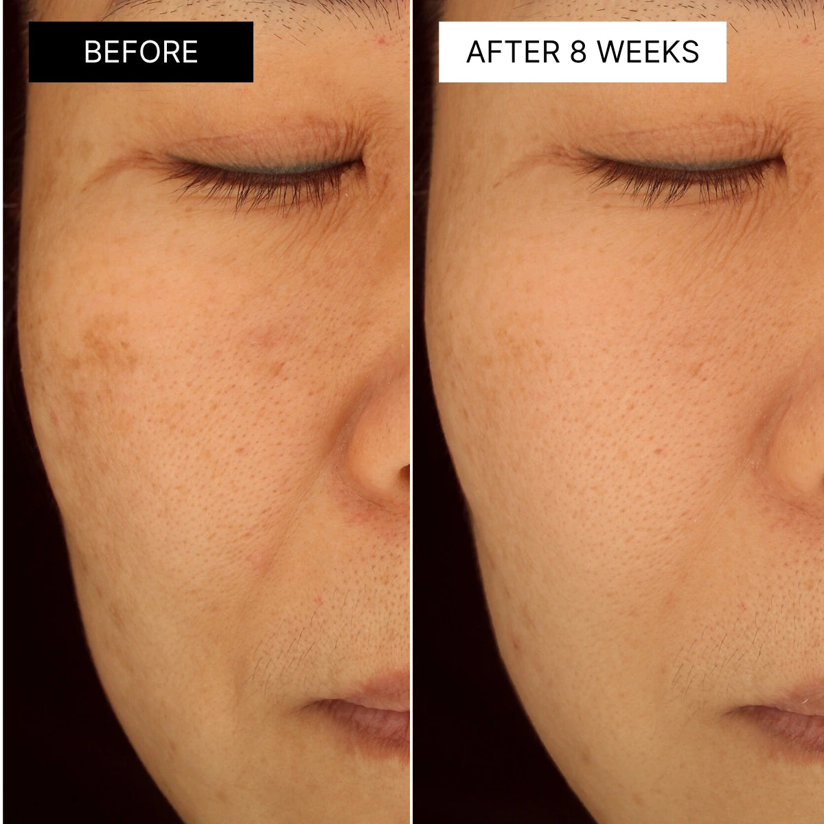 The Korean Travel Kit for Mature Skin